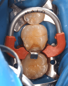 Blog_Halo_Clinical_Guide_DrGoh_2