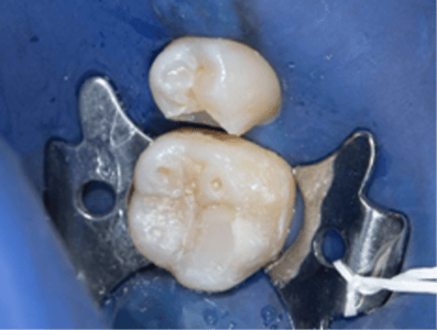 Blog_Halo_Clinical_Guide_DrRichins_1