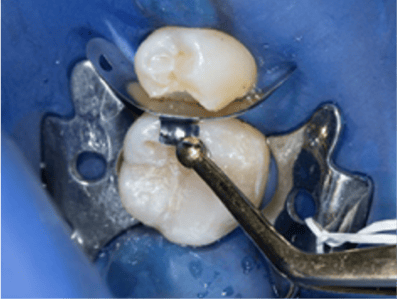 Blog_Halo_Clinical_Guide_DrRichins_2