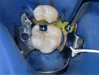 Blog_Halo_Clinical_Guide_DrRichins_3