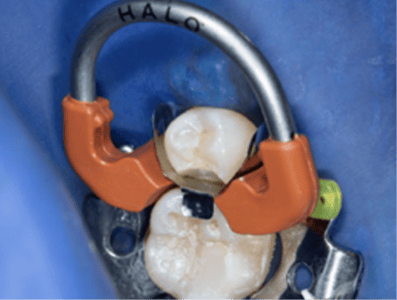 Blog_Halo_Clinical_Guide_DrRichins_4
