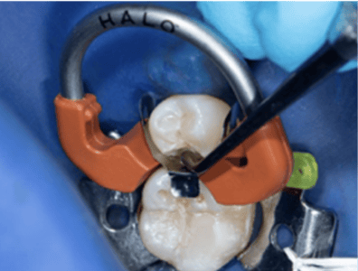 Blog_Halo_Clinical_Guide_DrRichins_5