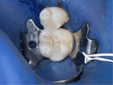 Blog_Halo_Clinical_Guide_DrRichins_7
