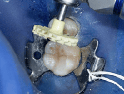 Blog_Halo_Clinical_Guide_DrRichins_8