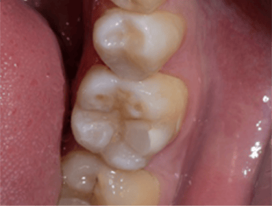 Blog_Halo_Clinical_Guide_DrRichins_9