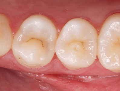 Blog_Halo_Clinical_Guide_DrWright_1