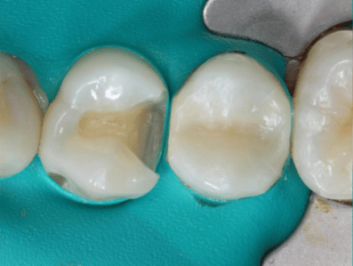 Blog_Halo_Clinical_Guide_DrWright_2