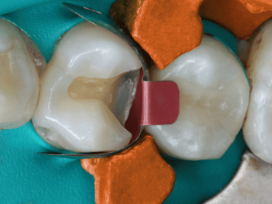 Blog_Halo_Clinical_Guide_DrWright_3