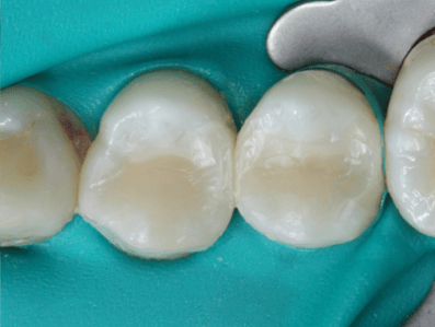 Blog_Halo_Clinical_Guide_DrWright_5