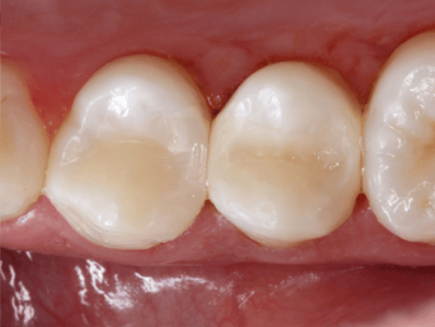 Blog_Halo_Clinical_Guide_DrWright_6