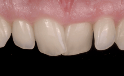 Transcend Mascetti 1