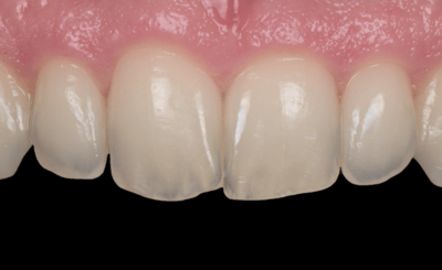 Transcend Mascetti 2