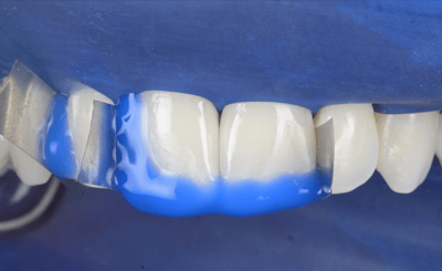 Transcend Mascetti 4