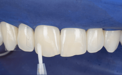 Transcend Mascetti 5